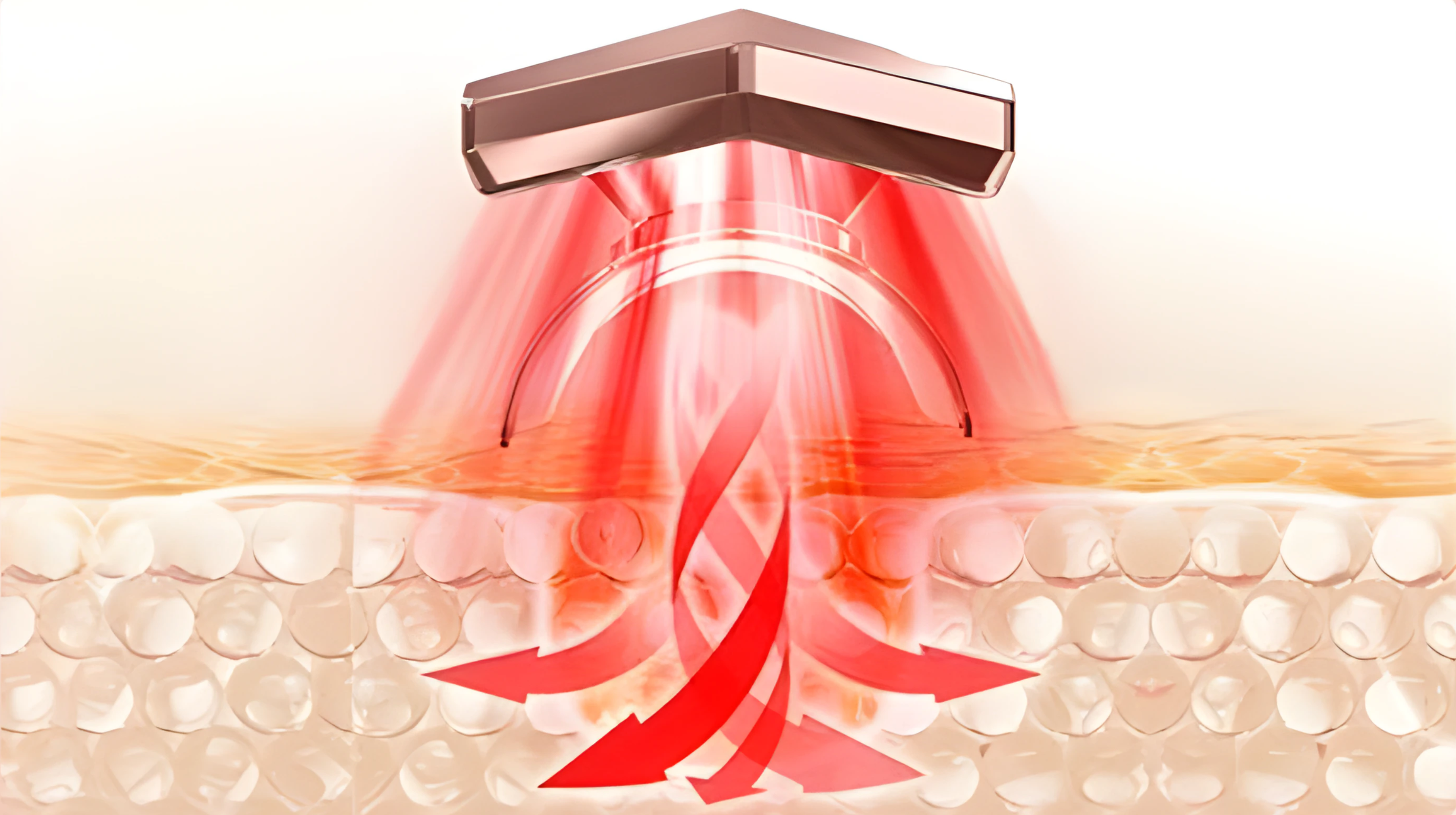 Alt Image