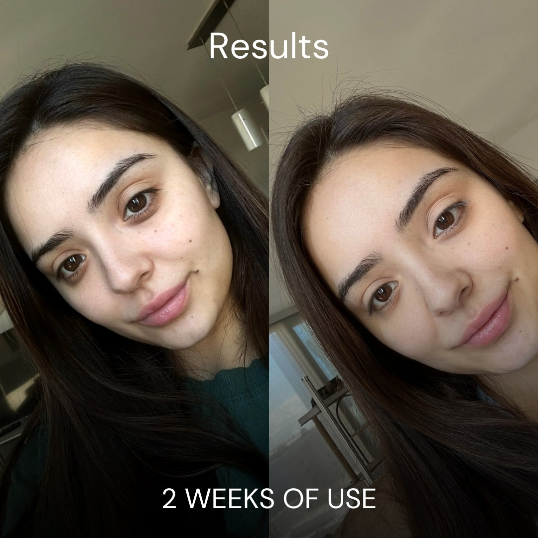 Medex Eye Perfector X-100